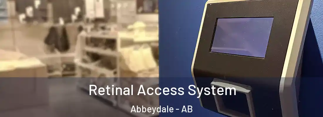  Retinal Access System Abbeydale - AB